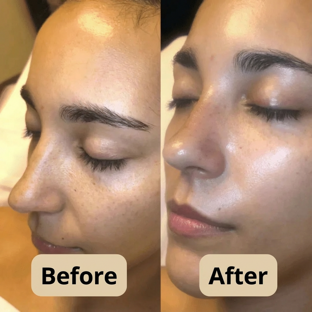 Clear Skin Duo — Pores, Dead Skin & Irregular Texture