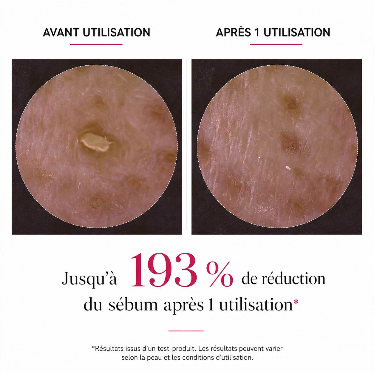 Clear Skin Duo — Pores, Dead Skin & Irregular Texture